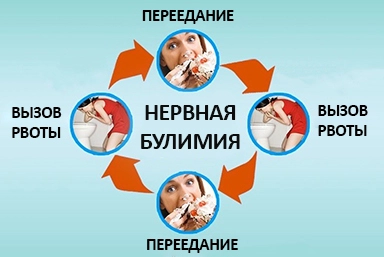 Лечение булимии в Ступино